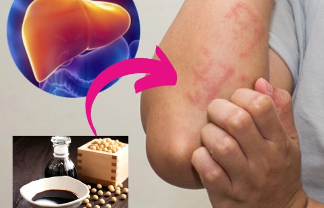 3 loại gia vị nhà nào cũng có nhưng "ngấm ngầm" làm gan tổn thương, ngon miệng đến mấy cũng đừng ăn