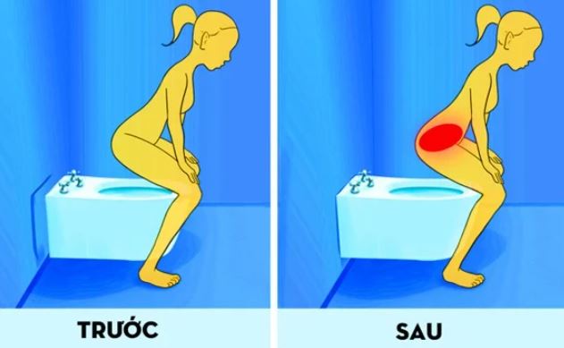 Tư thế đi vệ sinh sai be bét khiến chị em dễ bị nhiễm trùng đường tiết niệu