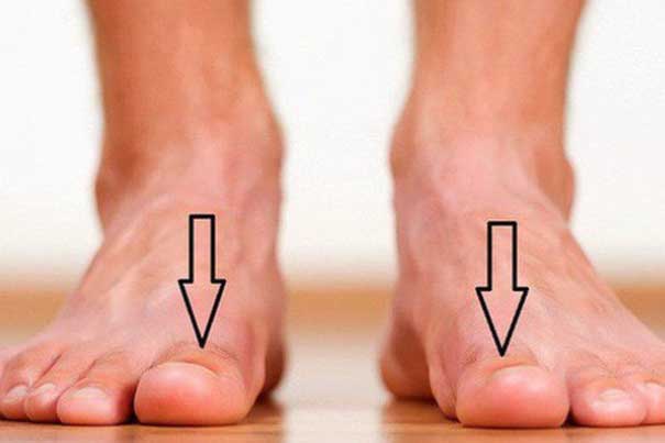 Dấu hiệu nhỏ trên bàn chân cảnh báo "trọng bệnh", nhiều người chủ quan đến khi đi khám thì đã quá muộn