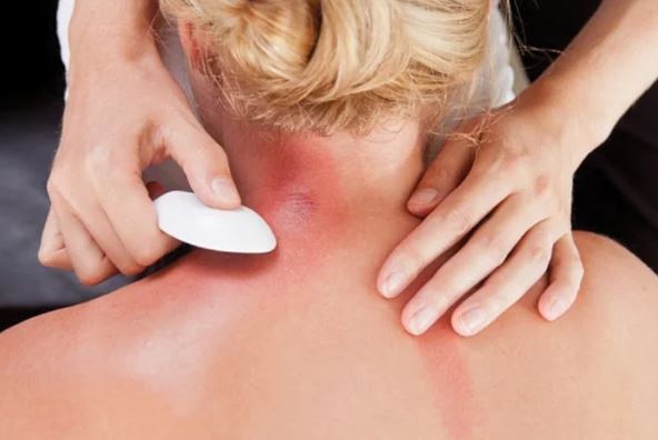 Bật mí 5 cách cạo gió tại nhà đơn giản nhưng cực kỳ hữu hiệu