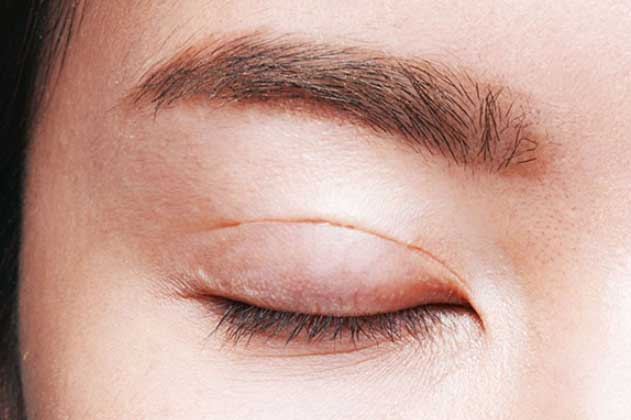 Ngoài nếp nhăn, khuôn mặt xuất hiện 5 dấu hiệu này chứng tỏ đang lão hóa nhanh