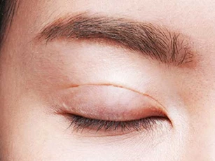 Ngoài nếp nhăn, khuôn mặt xuất hiện 5 dấu hiệu này chứng tỏ đang lão hóa nhanh