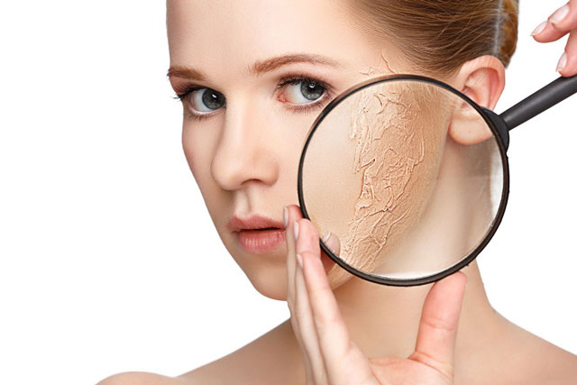 6 bí quyết chăm sóc da khô "cằn cỗi" ngày Đông bạn không bao giờ được quên