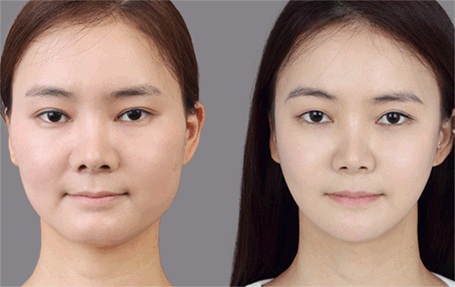 Nhớ 3 điều này bạn hết béo mặt ngay lập tức