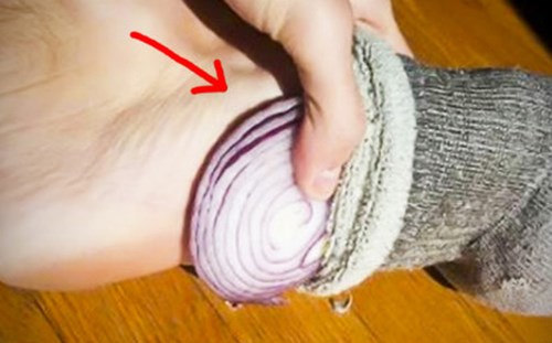 Đắp hành tây vào chân trước khi ngủ bạn sẽ thấy điều "thần kỳ"