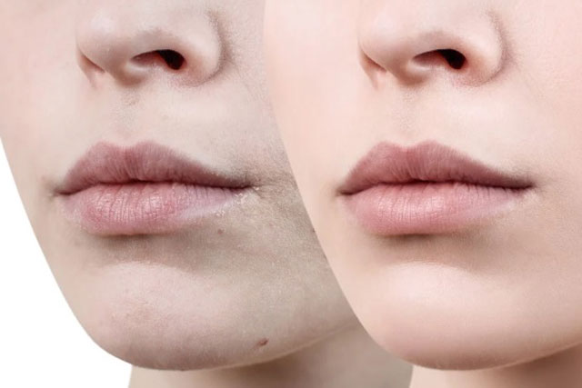 3 công thức giúp bạn trị môi thâm tại nhà hiệu quả