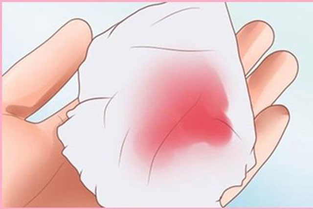 Phụ nữ đến kì kinh nguyệt hay bị vón cục có sao không?