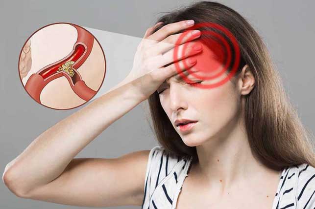 Bị thiếu máu não đừng chủ quan vì có thể gây đột quỵ: 5 dấu hiệu nhận biết, người trẻ lưu ý