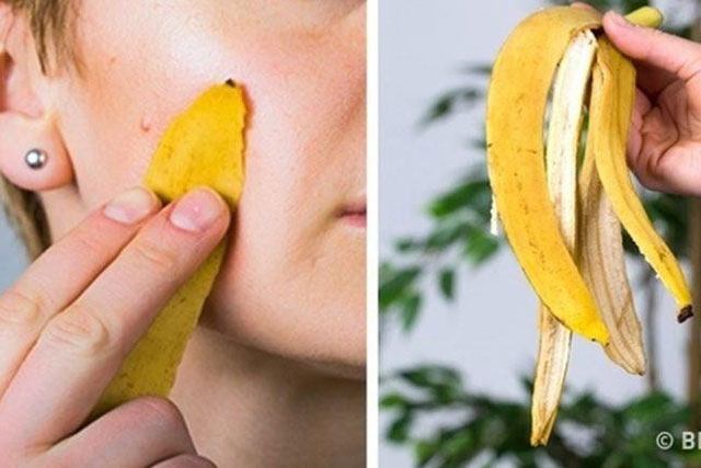 6 công dụng làm đẹp thần kỳ từ vỏ chuối không nhiều người biết