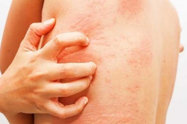 Dấu hiệu xuất hiện lặp đi lặp lại vào ban đêm cảnh báo gan yếu 'xơ xác', đi viện ngay kẻo muộn