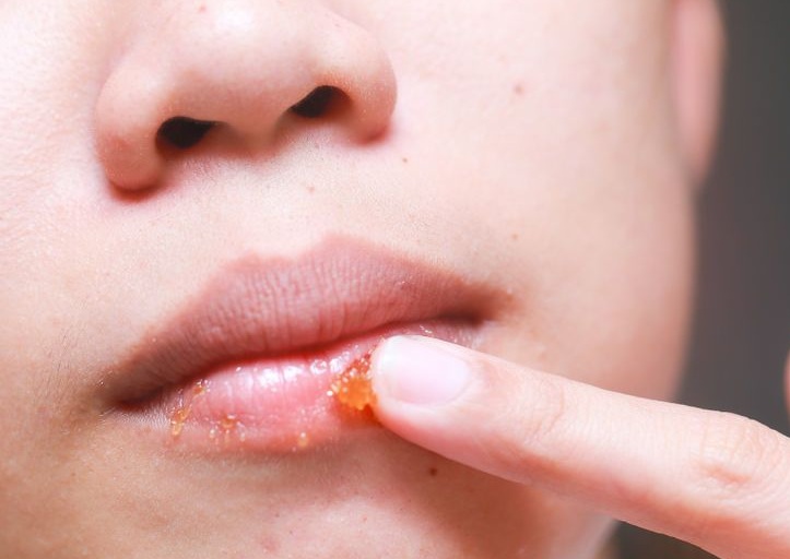 Mẹo giúp môi không bị 'nhiễm' chì khi đánh son