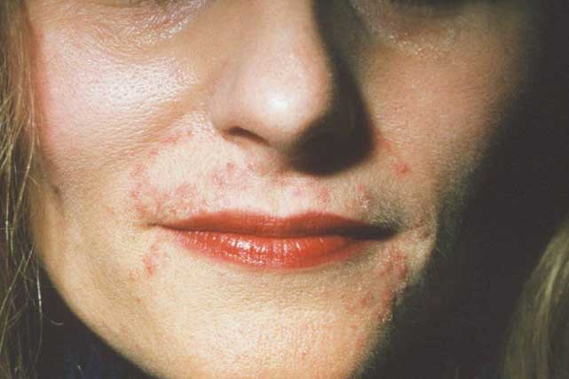 Phụ nữ thấy 6 tín hiệu cảnh báo này, hãy nhanh chân đi gặp bác sĩ ngay kẻo hối không kịp