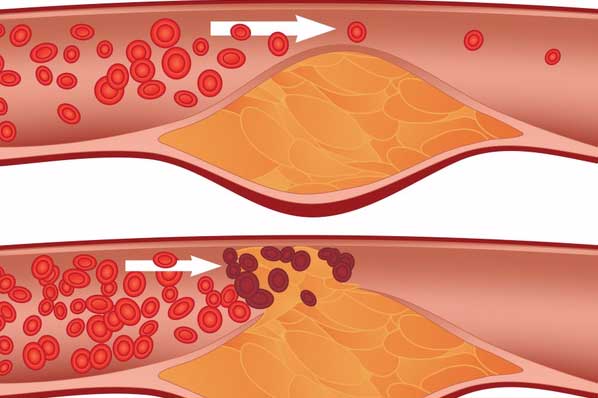 Bác sĩ Nhật hướng dẫn cách 'tắm sạch' huyết quản, ai làm được thì sống khỏe mạnh đến già