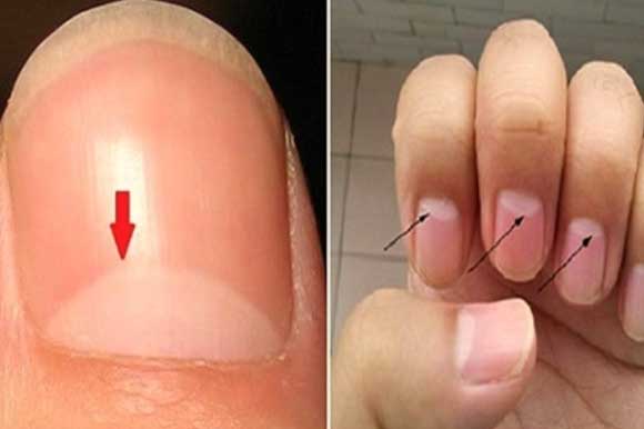 Cơ thể xuất hiện 2 đỏ 1 mùi gan của ban đang suy kiệt, càng để lâu càng rút ngắn tuổi thọ