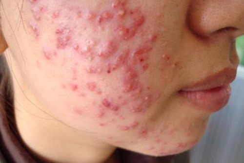 Thay đổi bất thường ở da rất có thể bạn đã mắc bệnh nguy hiểm