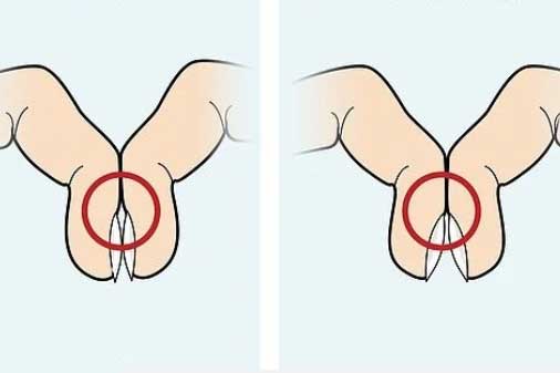 Bỏ 1 giây quan sát bàn tay có thể phát hiện sớm ung thư phổi