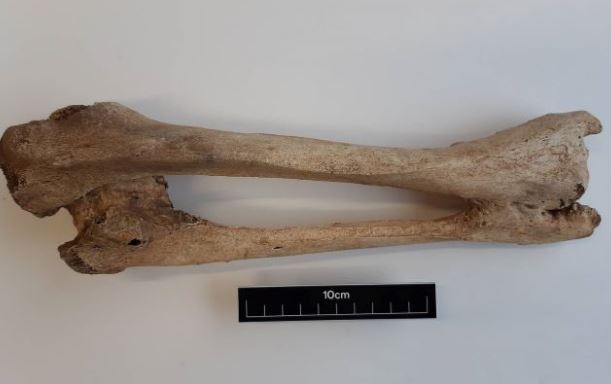 Phát hiện nguyên nhân di truyền gây u xương ở bộ hài cốt 1.000 năm tuổi