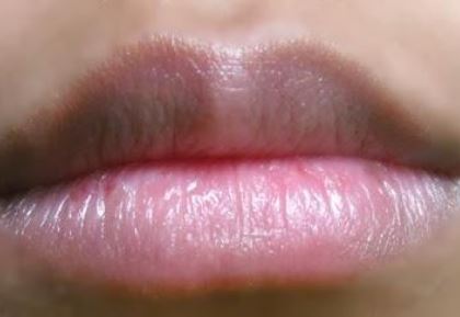 Công thức đặc biệt với quả chanh để hết môi thâm