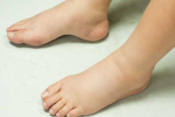 Tín hiệu của cơ thể cảnh báo bạn đang "nạp" quá nhiều muối, số 3 rất nhiều người mắc phải