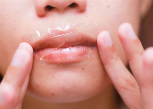 Không cần son dưỡng môi vẫn hồng hào "vạn người mê"