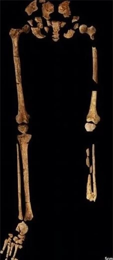 Phát hiện bằng chứng ca phẫu thuật chân sớm nhất trong lịch sử ảnh 2