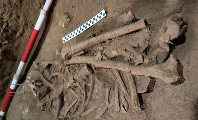 Phát hiện bằng chứng ca phẫu thuật chân sớm nhất trong lịch sử