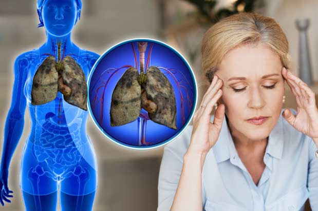 Dấu hiệu chứng tỏ phổi của bạn đang "kêu cứu", rất nhiều người vẫn chủ quan bỏ qua