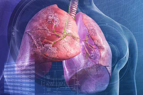 Thấy cơ thể có 2 chỗ lồi và 3 chỗ đen sạm, cẩn thận phổi đang "thủng lỗ chỗ" từng ngày