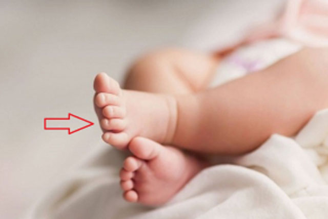 Đứa trẻ sinh ra có 6 đặc điểm này, tương lai có chiều cao vượt trội