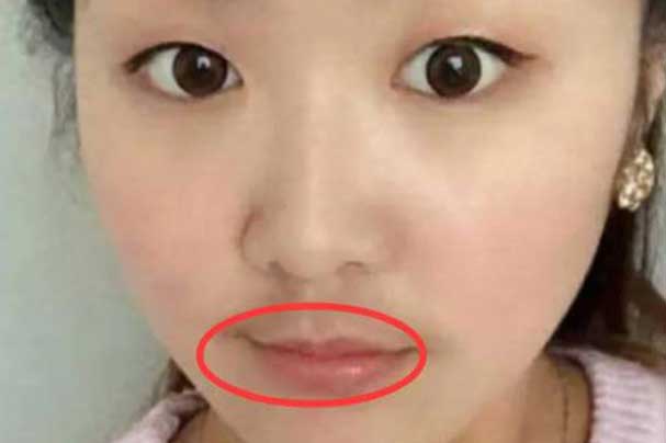 Mặt bỗng có 5 dấu hiệu xấu xí này chứng tỏ tử cung của bạn có vấn đề, chớ chủ quan