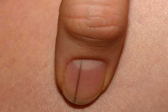 '2 đen, 2 mùi' trên cơ thể cảnh báo gan bị bệnh rất nặng