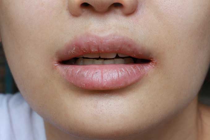 2 dấu hiệu xuất hiện cả ngày lẫn đêm chính là do bệnh tiểu đường, không cần xét nghiệm cũng biết