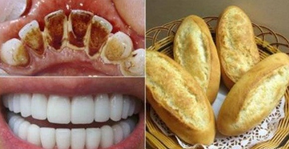 Dùng 1 chiếc bánh mỳ cao răng bao nhiêu cũng bong sạch