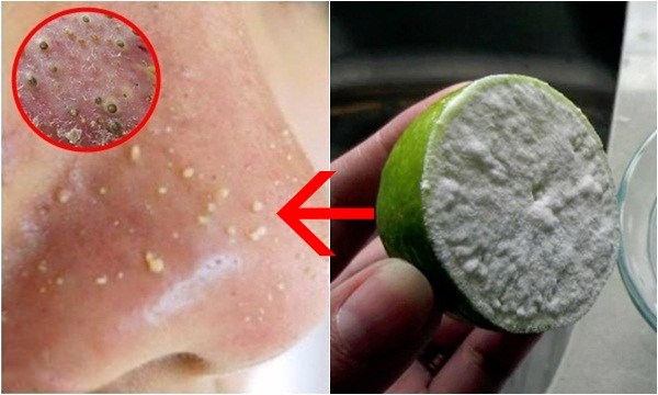 Chà chanh chấm muối lên mặt mụn bao nhiêu cũng bay hết