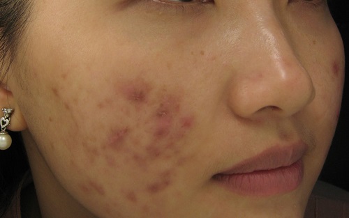 Dùng mỹ phẩm hàng hiệu không bằng uống nước này