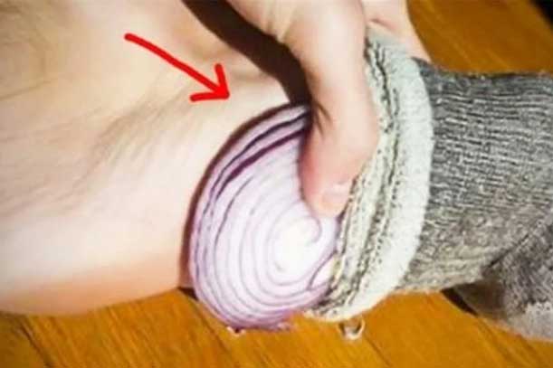 Đắp hành tây vào lòng bàn chân trước khi đi ngủ, nhận ngay lợi ích tuyệt vời