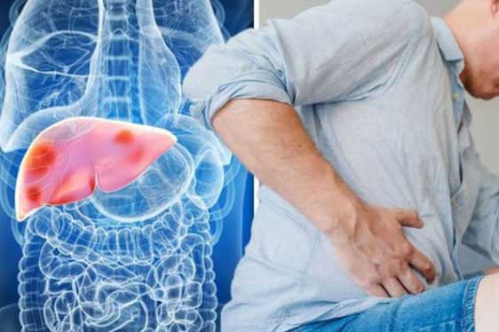 Thấy 4 vùng trên cơ thể bị đau, cảnh báo bệnh gan đã đi vào giai đoạn nặng