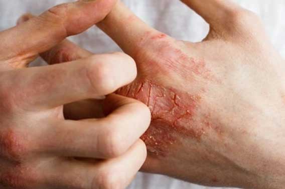 Cảnh báo 2 bộ phận trên cơ thể bị ngứa, nhanh chân đi gặp bác sĩ ngay