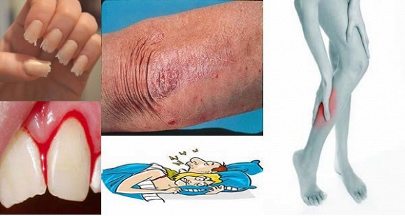 Khi cơ thể có biểu hiện này hãy vào viện khám ngay kẻo hối không kịp