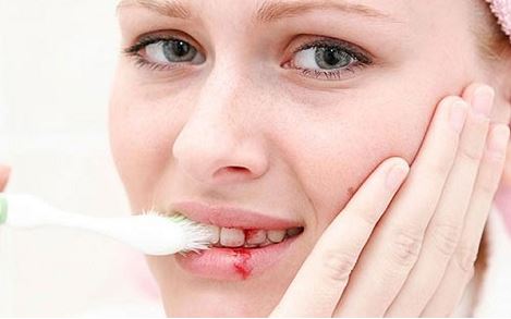 Chảy máu chân răng là dấu hiệu nhiều bệnh nguy hiểm