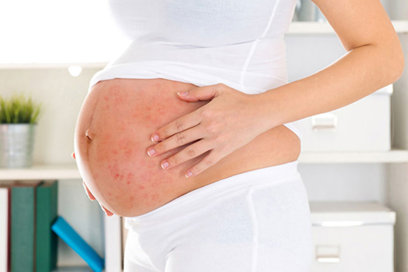 Cách chăm sóc bà bầu khi bị sốt xuất huyết