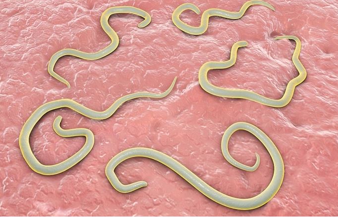 Hướng dẫn cách trị giun kim tại nhà