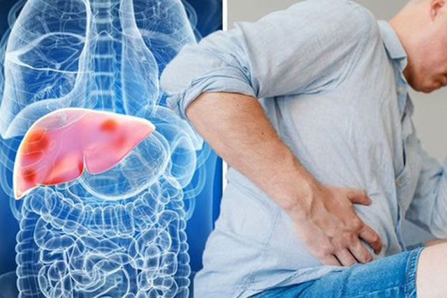 Thấy 4 vùng trên cơ thể bị đau, cảnh báo bệnh gan đã đi vào giai đoạn nặng