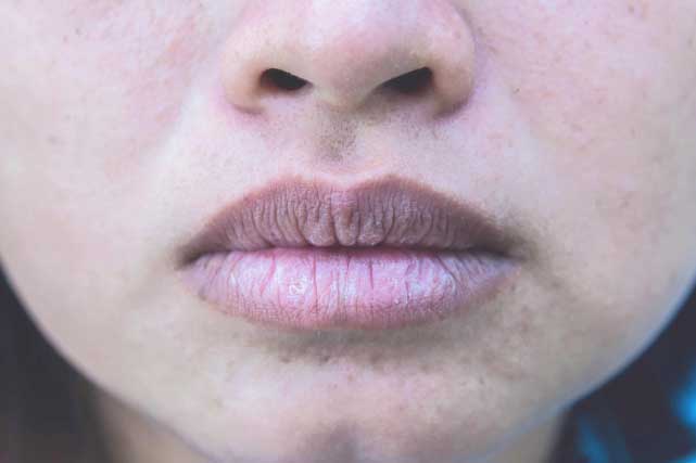 4 dấu hiệu bất thường trên mặt cảnh báo bệnh gan, khám nhanh kẻo 'hết đường cứu'