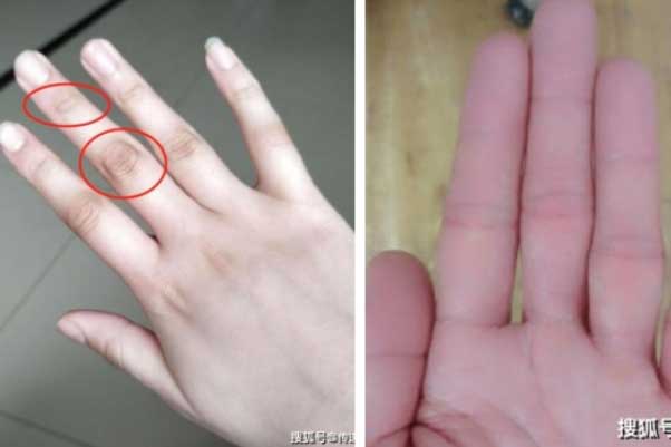 Muốn biết gan khỏe hay yếu, nhìn vào ngón tay giữa cũng đoán được phần nào