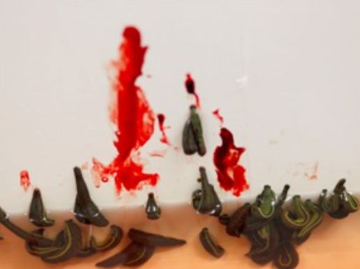 Lý do đỉa vẫn được sử dụng trong y học ngày nay