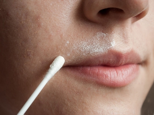 Bất ngờ với 9 công dụng làm đẹp “rẻ như bèo” từ oxy già ít người biết