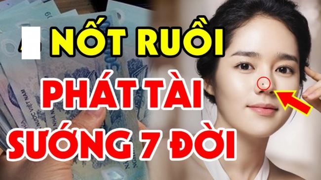 5 nốt ruồi thần Tài "đánh dấu", phụ nữ có 1 cái thôi cũng sướng cả đời
