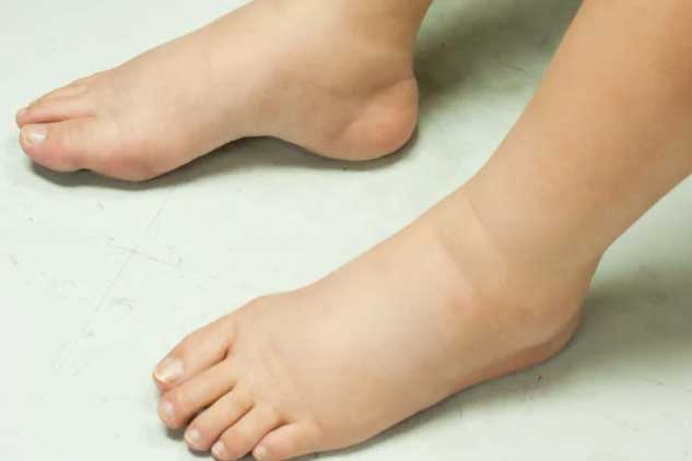 3 bất thường khi thức dậy vào buổi sáng cảnh báo bệnh thận, tiểu đường đang 'gõ cửa'