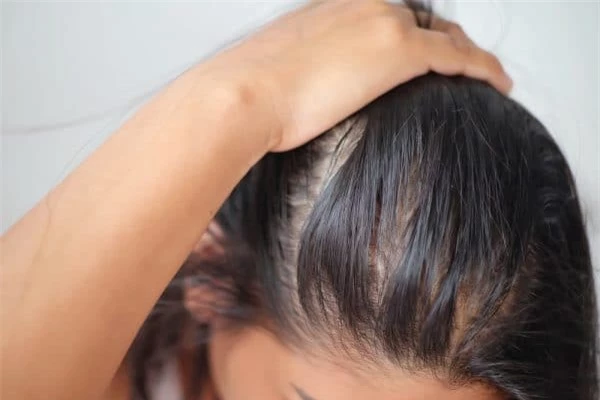 5 cách giúp tạm biệt mái tóc bết dính